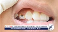 العناية بالأسنان… عادة صحية تحافظ على الجمال وتقي من الأمراض