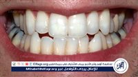 العناية بالأسنان.. سر الابتسامة الجميلة والصحة الدائمة