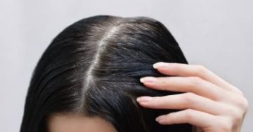 5 علامات لتلف الشعر تدل على مشكلات فى الكبد والكلى